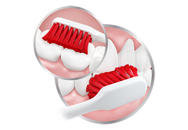 How You Can Prevent Bleeding Gums When Brushing Teeth